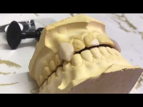 DIY Vampire Fangs Custom Fit Professional Dental Grade Quality Cosplay/Halloween/Anime Fun and Easy!