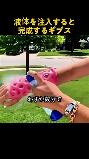 医師も驚愕！最近の骨折治療で使われる最先端ギプスがこれ #次世代ギプス #画期的アイテム #液体ギプス