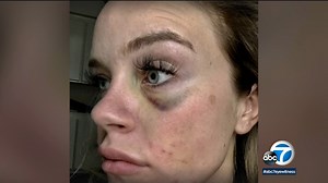 Ex sheriff's deputy speaks after jury finds her attacker not guilty