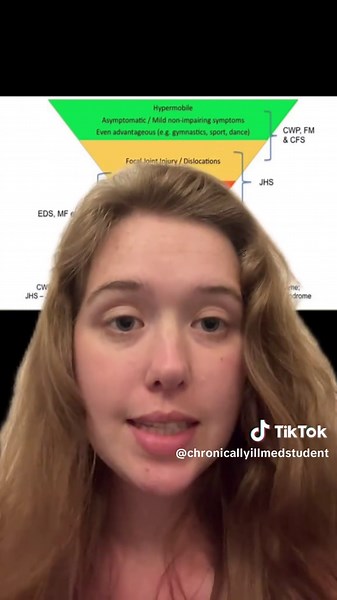 Understanding EDS and HEDS: Connective Tissue Disorders