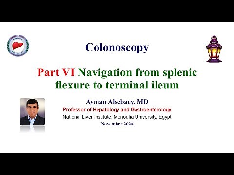 Colonoscopy Part VI Navigation of the splenic flexure to TI 2024