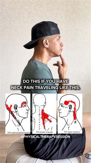 NECK PAIN WITH RADIATING PAIN RELIEF 🤩🤩🤩 #backcrack #chiropractic #trendingreels #neckpain | Physical Therapy Session