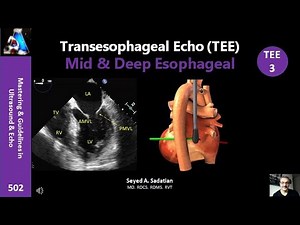 Transesophageal Echo (TEE) 3: Mid & Deep Esophageal