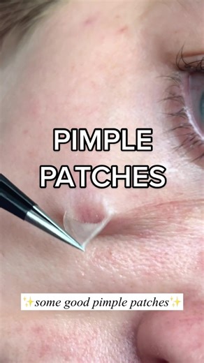 🥺👉🏻👈🏻 just me and my pimple patches