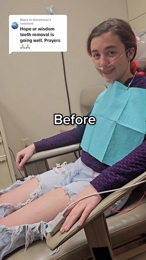 Success🙌 #wisdomteethaftermath | Burn the Jukebox