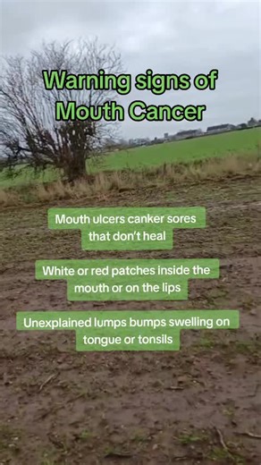 Critical Warning Signs of Oral Cancer You Must Know