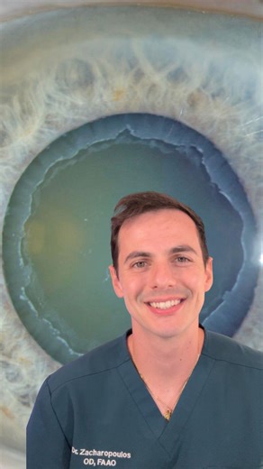 ⚠️Post op cataract surgery on a patient with PXF = higher risk! Think zonular weakness, capsular phimosis, IOL and IOL decentration. Save this for boards and clinic! #optometryschool #futureOD #optometrylife #optometrystudent #eyedoc #dominate #kmkoptometry