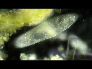 Olympus BX50 Dark field Microscopy