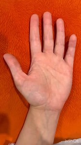 What is reflexology? Reflexology is about transmission and reception. Energy is transferred to the patient through the therapist's hands and information is received from the patient's. Follow Backpain Rrelief for daily pain relief tips! 📚 Reflexology is a comprehensive treatment method that includes pressure and massage of the reflex points on the palms and soles The word reflex is used here in the sense of reflection or mirror image. The reflex points act as small mirrors that reflect the whol
