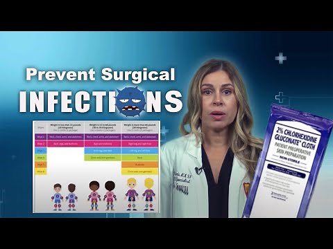 How to clean your child's skin prior to surgery with CHG wipes