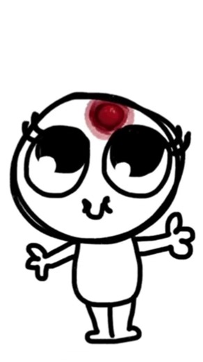 Me once a week #pimple#relatable#art#animation#digitalart