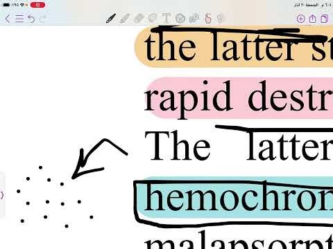 Estimation of total iron & iron binding capacity