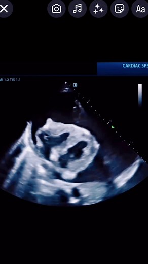 Shimmying to the Cath Lab: Healthcare Humor