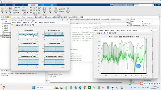 【心电信号ECG】基于matlab心电图波形检测R峰计算心率【含Matlab源码 14048期】
