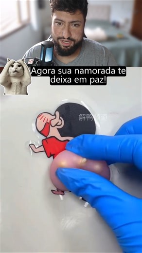 Now your girlfriend will leave you alone! 😅 #pimple #couple #boyfriend