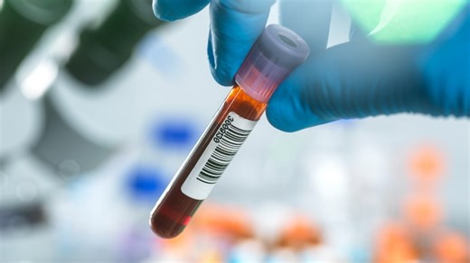 US FDA approves new blood test for detecting colon cancer