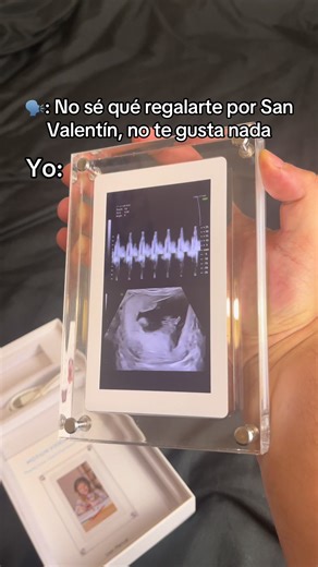 ✨ Tu primera foto, tu primer recuerdo… 💕 Este cuadro de ecografía te permitirá revivir cada latido y cada emoción de tu embarazo 👶❤️ Un recuerdo eterno del momento más mágico de tu vida ✨ #cuadropersonalizado #regalospareja #ultrasonido #embarazo #marcodigital Cuadro ecografía, recuerdo embarazo, cuadro digital bebé, primer latido, regalo embarazo