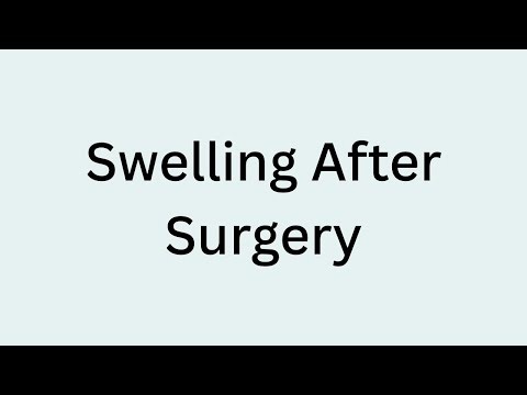 What Post Surgery Swelling Does — and Does Not — Mean