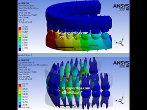 Simulation of biting with full separate teeth and solid jaw (v1) - ANSYS Workbench Explicit Dynamics