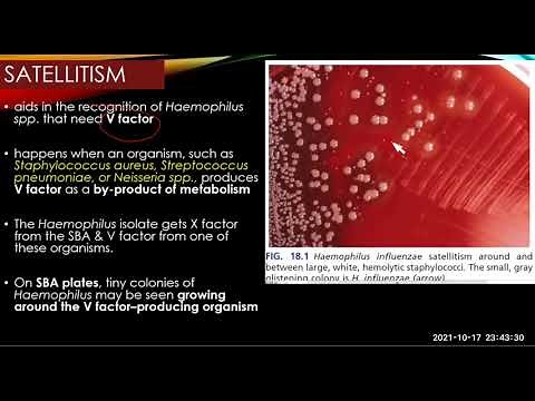 Haemophilus and HACEK group