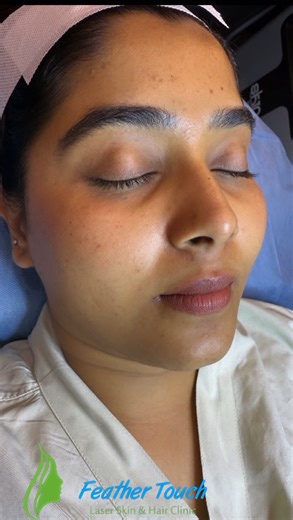 Feather Touch Aesthetic Clinic & Academy™️ on Instagram: "Thanks for trusting us😄 @aishwaryashindogi_official Its many benefits include a more hydrated, bright, plump, and clear complexion. Plus, it can also improve signs of aging The treatment reduces fine lines and wrinkles, increases firmness, evens tone, texture, and brown spots, as well as reduces enlarged pores… @feather_touch_aesthetic_clinic @feather_touch_academy_ Dm now to book your Slot!! #laserhairremoval #laser #skincare #beauty #h