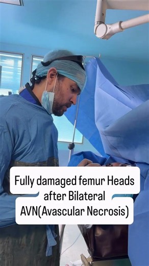 Advanced Bilateral Hip Replacement for AVN | Amazing Patient Reaction After Surgery | Dr. DP Sharma