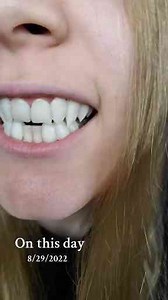 Throwback to My Favorite Vampire Fangs