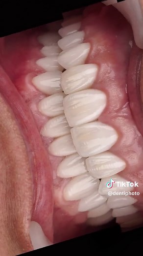 Dental Motion Design for beginners 🔥 Link in profile #dentalcase #dentist #estheticdentistry #dentistry #dentalphotography #dentalcourse #dental #dentalstudent #composite #dentistlife