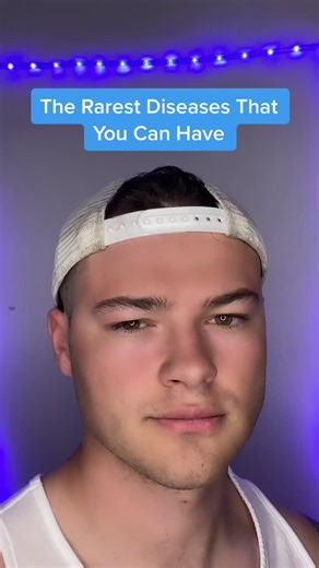 Understanding Progeria: The Rare Aging Disease