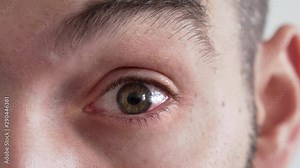 Red eye looking into camera, closeup