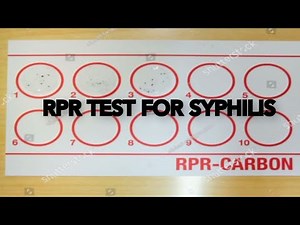 RPR( Rapid Plasma Reagin) test