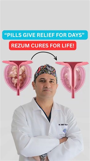 Tired of Prostate Pills? Rezum Gives Permanent Relief #rezumtherapy #rezum #drvineetmalhotra