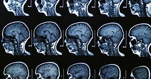 Criminal Minds: Brain scans spot the difference between intent and recklessness