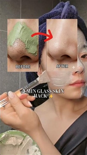 Pore concerns? Try the K-Beauty "Pore Vacuum"! 🤫🔬