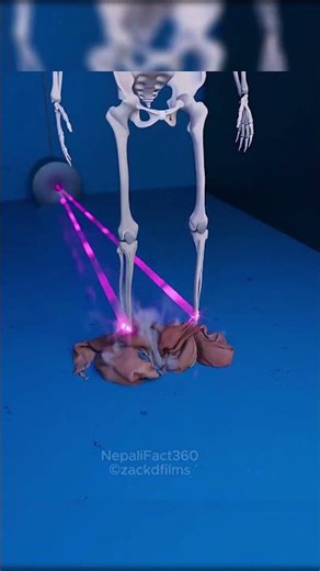 जब हाइड्रोलिक प्रेसले मानिसलाई थिच्छ 😱