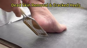 White Foot File & Callus Remover – Professional Pedicure Tool for Dead Skin Removal, Cracked Heels & Smooth Feet – Ultimate Stainless Steel Foot Scrubber for Soft, Healthy Feet (White A)