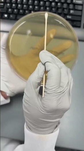 Antimicrobial susceptibility testing protocol for Haemophilus influenzae in medical microbiology lab