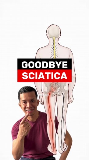42K views · 1.4K reactions | Sciatica pain relief!  FOLLOW FOR REMEDY TIPS! #sciatica #sciaticarelief #sciaticatreatment #BackPainRelief #physicaltherapy #physiotherapy #physio #fbreels | Physical Therapy Session | Facebook