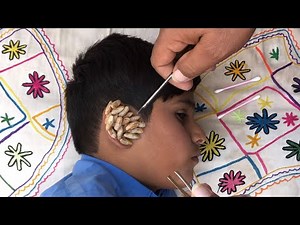 "Ultimate Ear Cleaning ASMR | Sleep & Relax Sounds