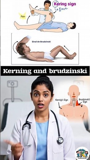 meningitis signs - kerning and brudzinski #neckpain #headache #fever #kattrucate #meningitis #test