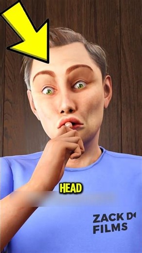 Finger Amputation Survival Guide‼️😱