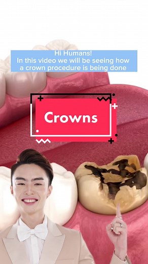 Dental Crowns Procedure: How It's Done