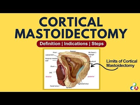 Cortical Mastoidectomy | Definition, Indications, Surgical Steps