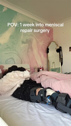 Recovery Journey After Meniscus Repair Surgery