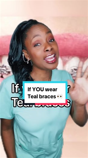 Teal Braces: A Stylish Choice for Brighter Smiles