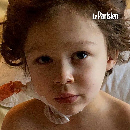 1.3M views · 9.4K reactions | Depuis deux ans, Joseph souffre d’une leucémie. Il a besoin d'une greffe de moelle osseuse pour survivre. Sa mère lance un appel aux dons ⬇️ | Le Parisien | Facebook