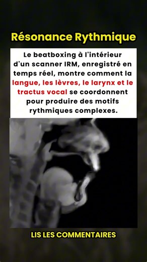 À Quoi Ressemble le Beatbox dans un Scanner IRM ? 🎤🧠