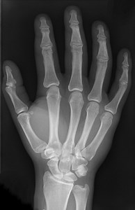 Diferencia entre rayos X y rayos gamma - Noticias 2025