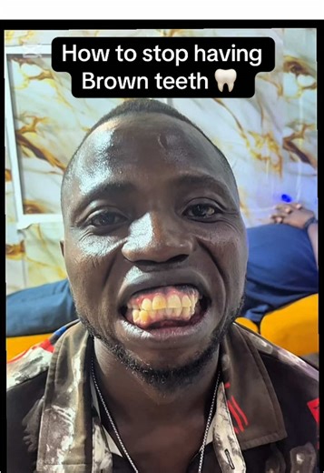 Effective Ways to Fix Brown Stained Teeth