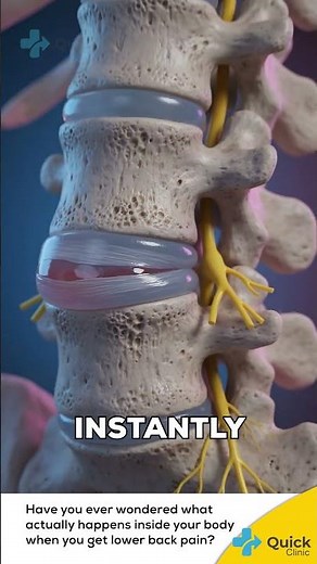 What Actually Happens When You Get Lower Back Pain